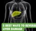 5 Ways to reverse Liver Damage